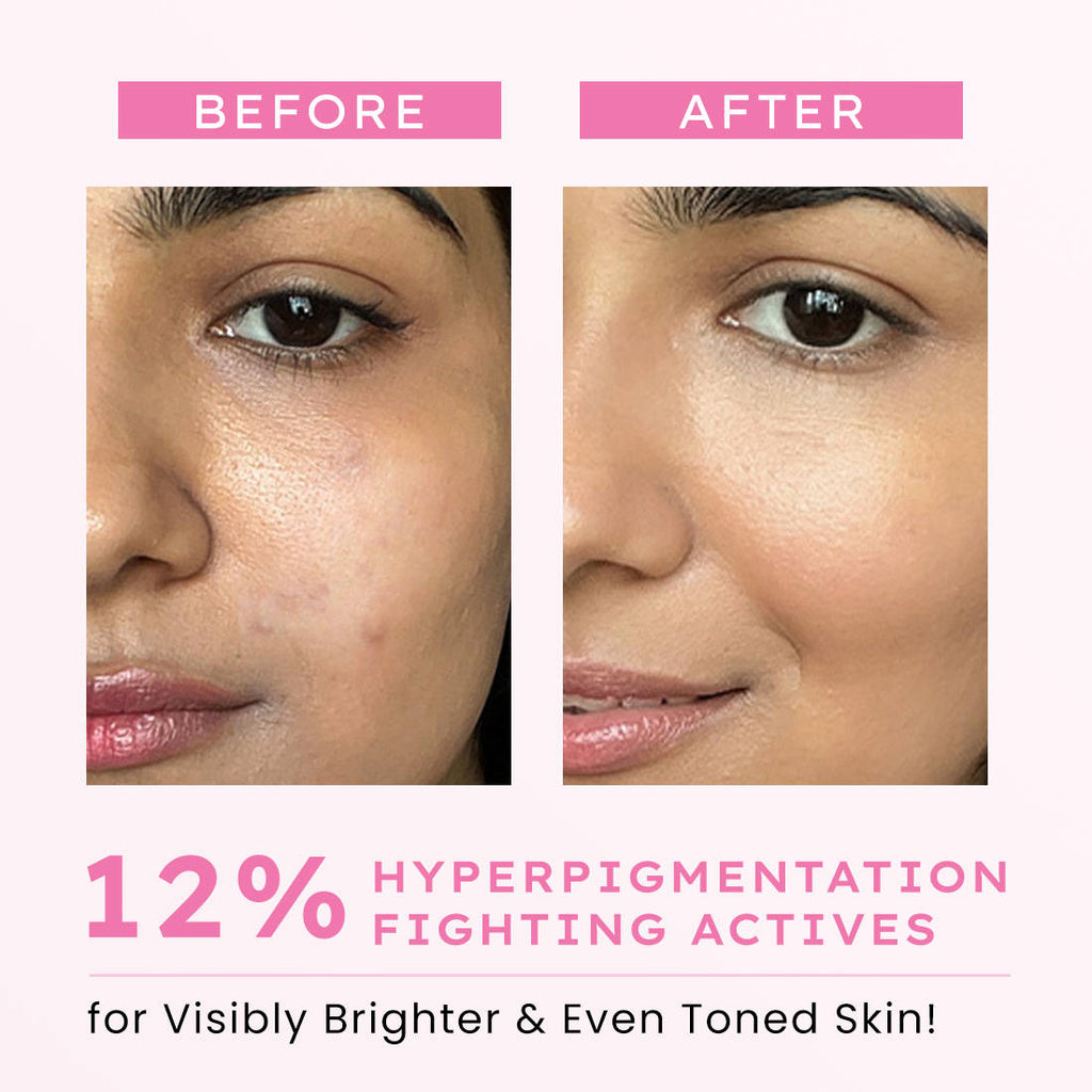 Advanced De-Pigmentation Serum | Z8 - view 4