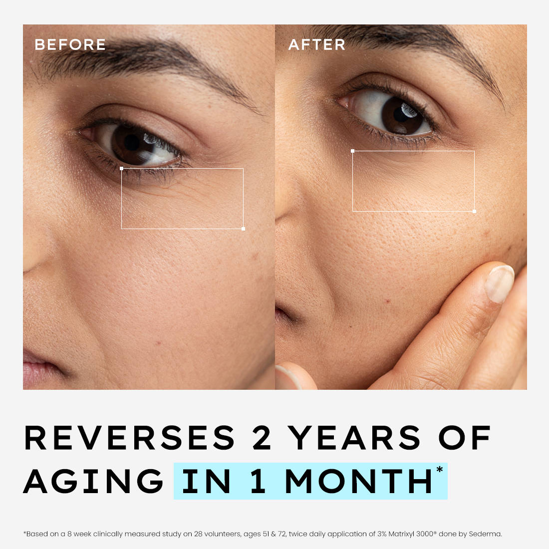 10% Power Peptide Cocktail Serum | Z8 - view 7