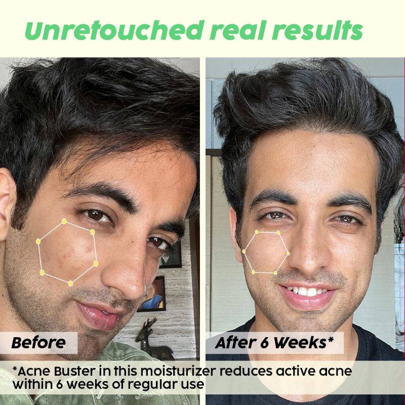 2% Niacinamide Jamun Moisturizer to Reduce Pimples for Oily & Acne Prone Skin, With Witch Hazel | PL1 - view 4