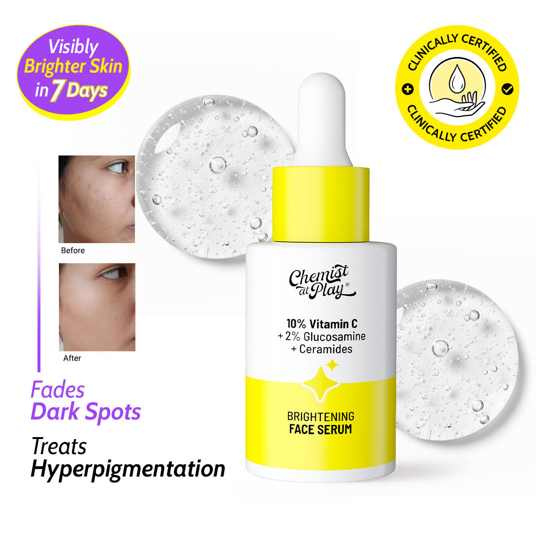 10% Vitamin C Face Serum Brightens Skin Treats Dark Spots & Hyperpigmentation | FC3 - view 10