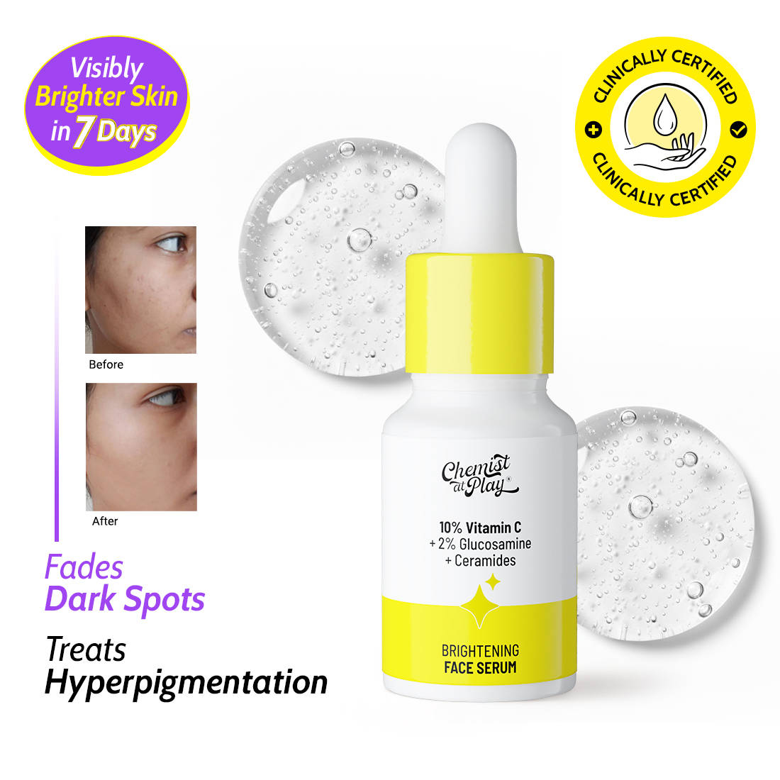 10% Vitamin C Face Serum Brightens Skin Treats Dark Spots & Hyperpigmentation | FC3 - view 1