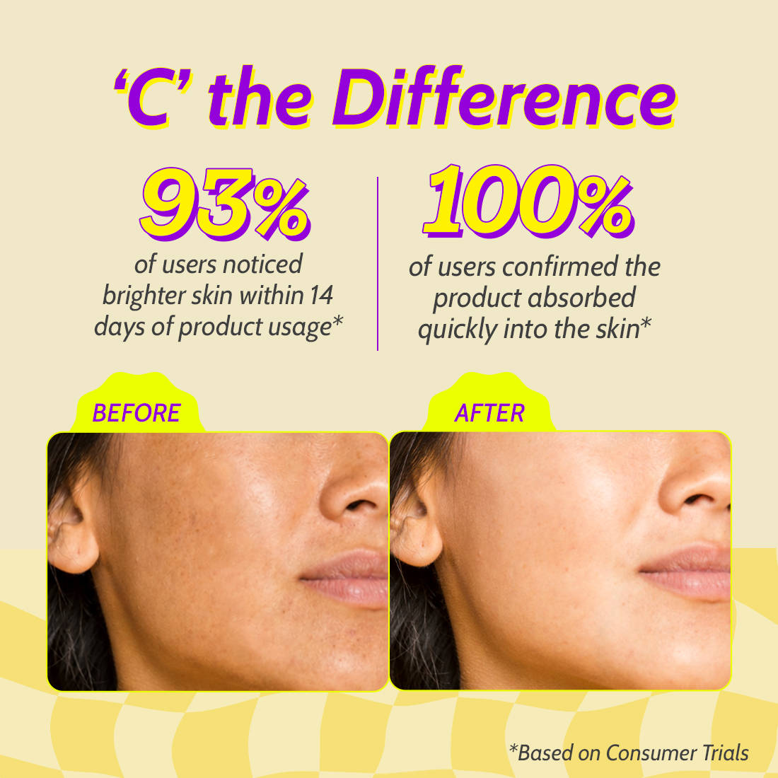10% Vitamin C Face Serum Brightens Skin Treats Dark Spots & Hyperpigmentation | Z8 - view 5
