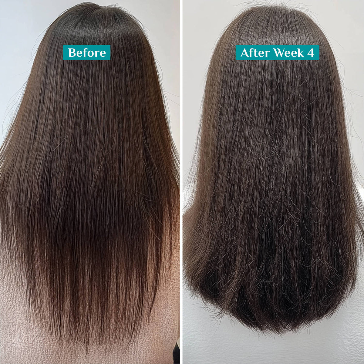 Redensyl & Anagain Hairfall Control Shampoo With Growth Boosters For Thick & Dense Hair | H85 - view 5