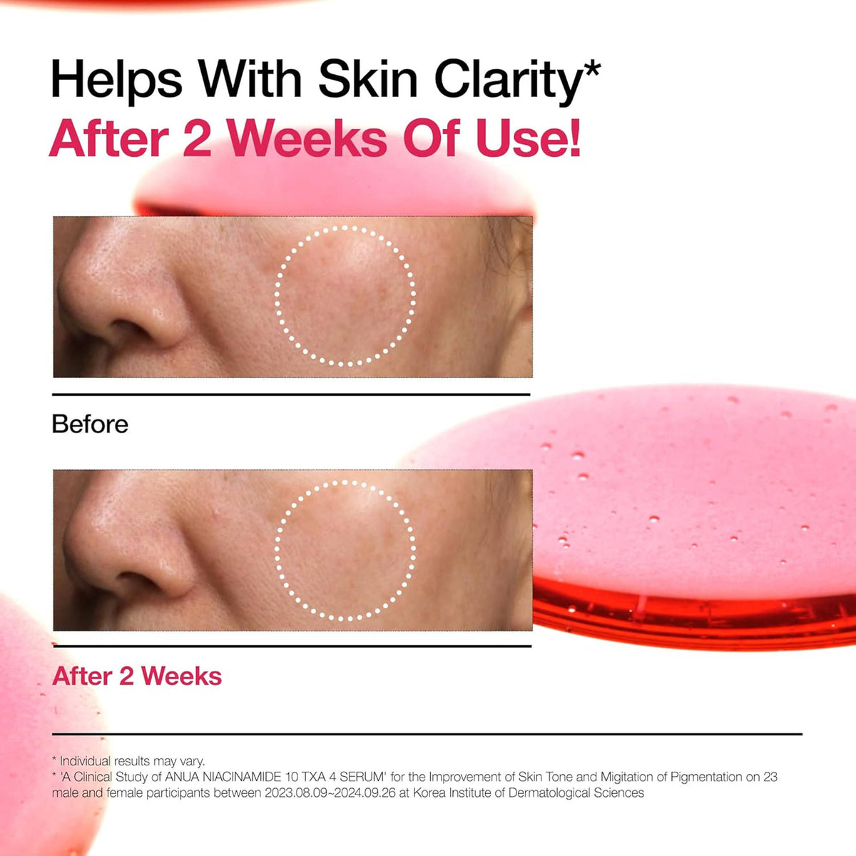 Niacinamide 10 Txa 4 Serum, Brightening Korean Serum For Dark Spots & Hyperpigmentation | Z8 - view 5