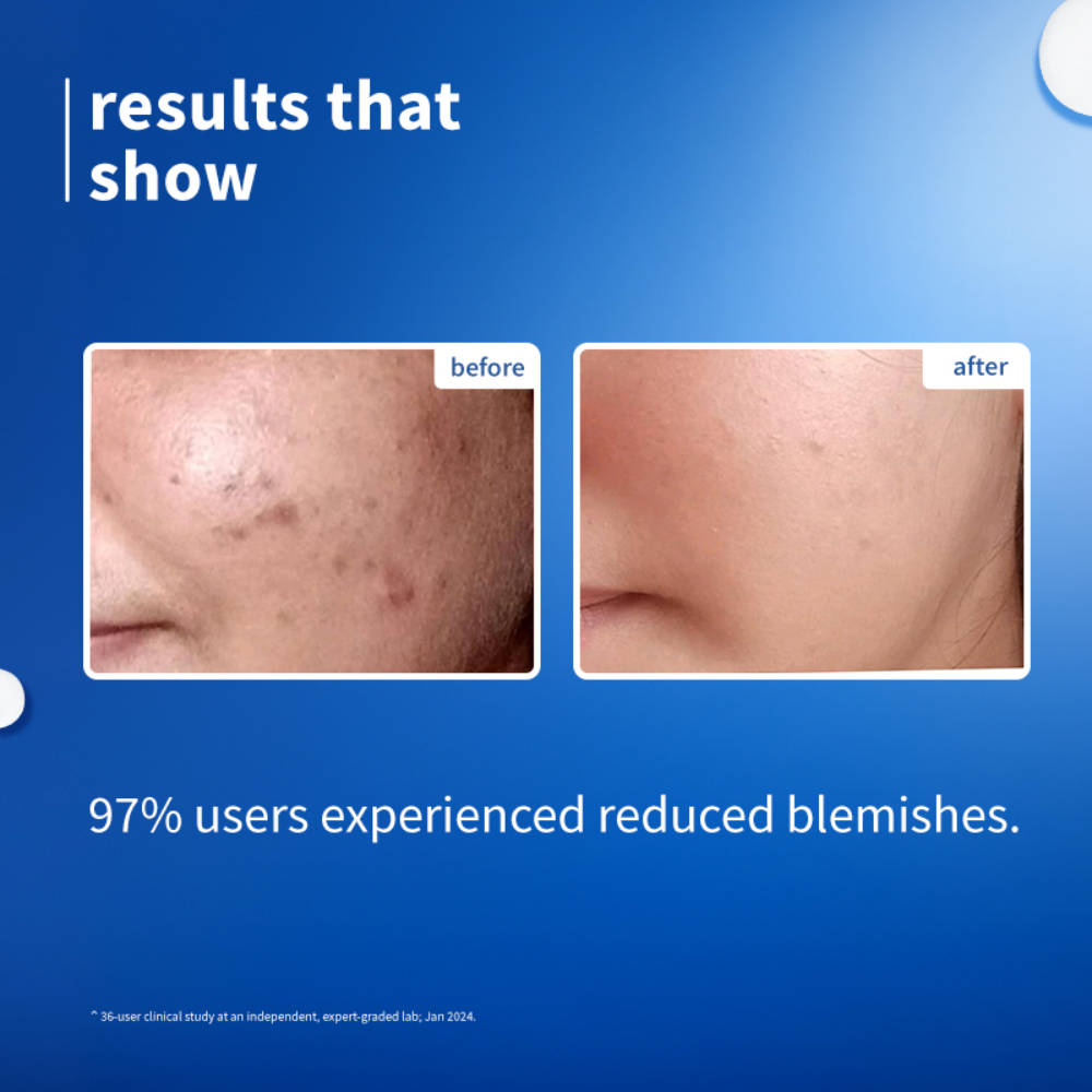 10% Niacinamide Brightening Face Serum with Rice Water, Fades Acne Marks, for Oily to Dry Skin | Z8 - view 3