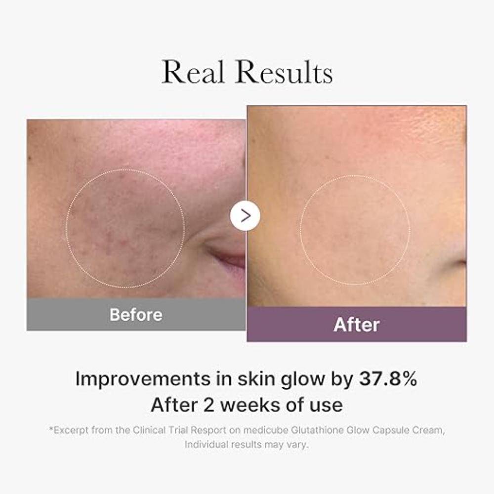 Age-R Glutathione Glow Capsule Cream | FC3 - view 5