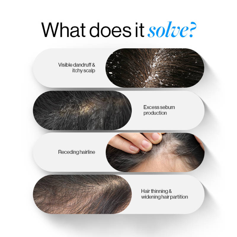 Hair Growth & Scalp Care Combo - Hair Growth Serum Roll On + Ketoconazole Shampoo | BWS9 - view 2