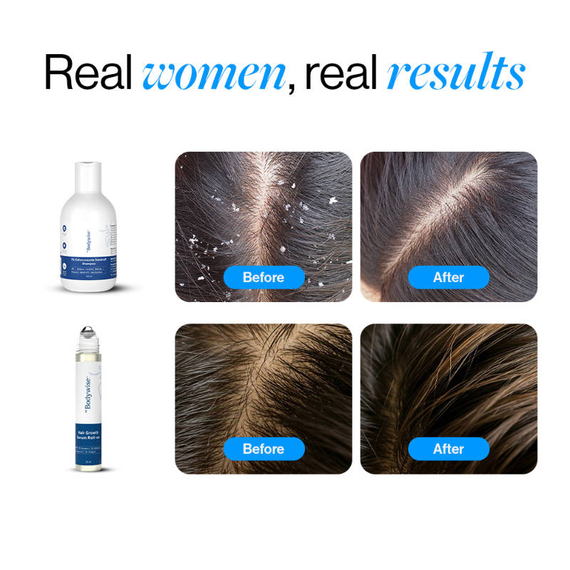 Hair Growth & Scalp Care Combo - Hair Growth Serum Roll On + Ketoconazole Shampoo | BWS9 - view 4
