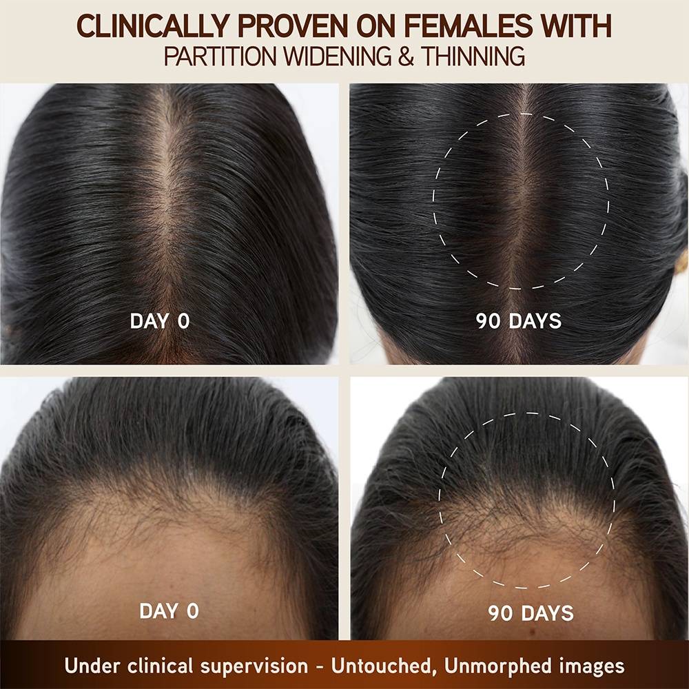 Bringha Hair Growth Treatment Scalp Serum | H85 - view 3