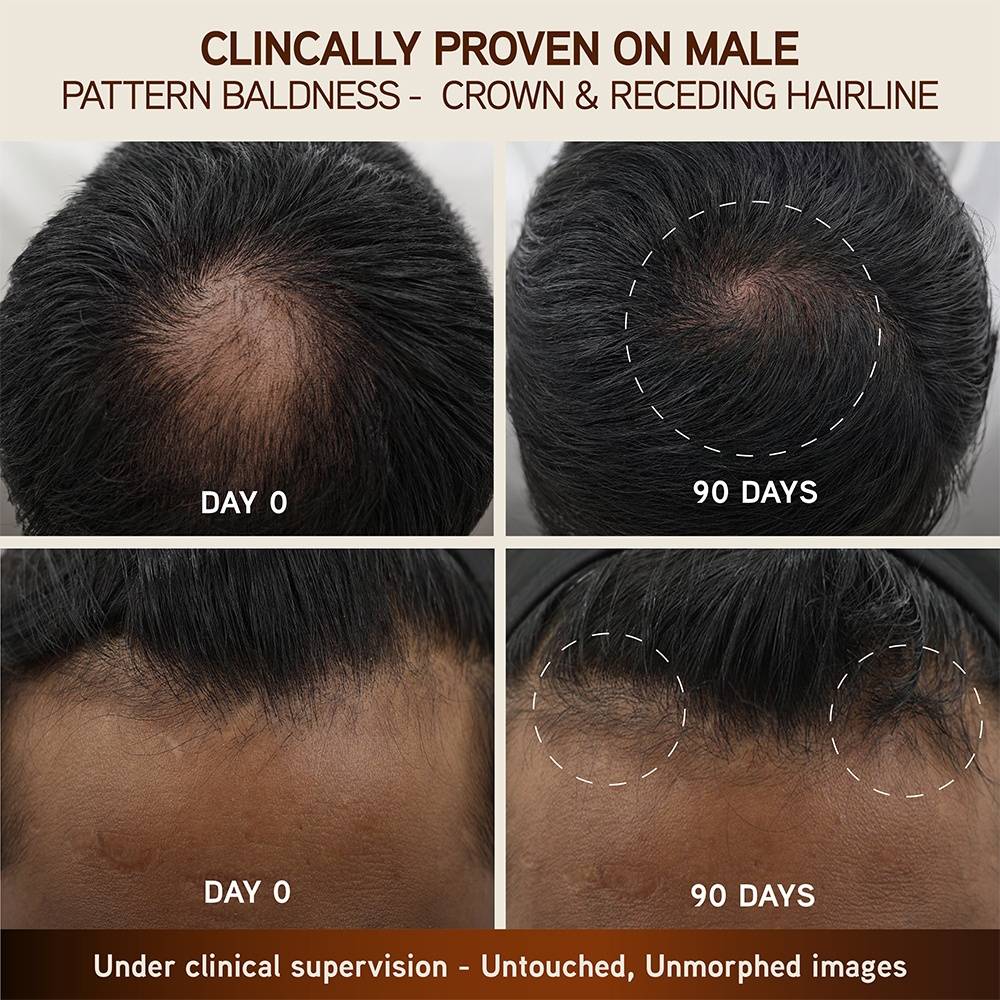 Bringha Hair Growth Treatment Scalp Serum | H85 - view 4