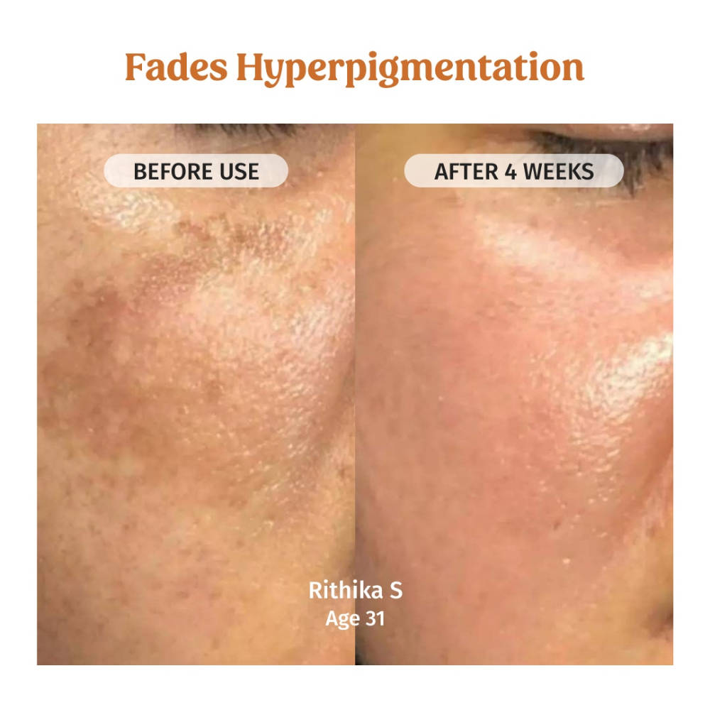 Milk Face Brightening Combo for Glowing & Even-Toned Skin | FC3 - view 3
