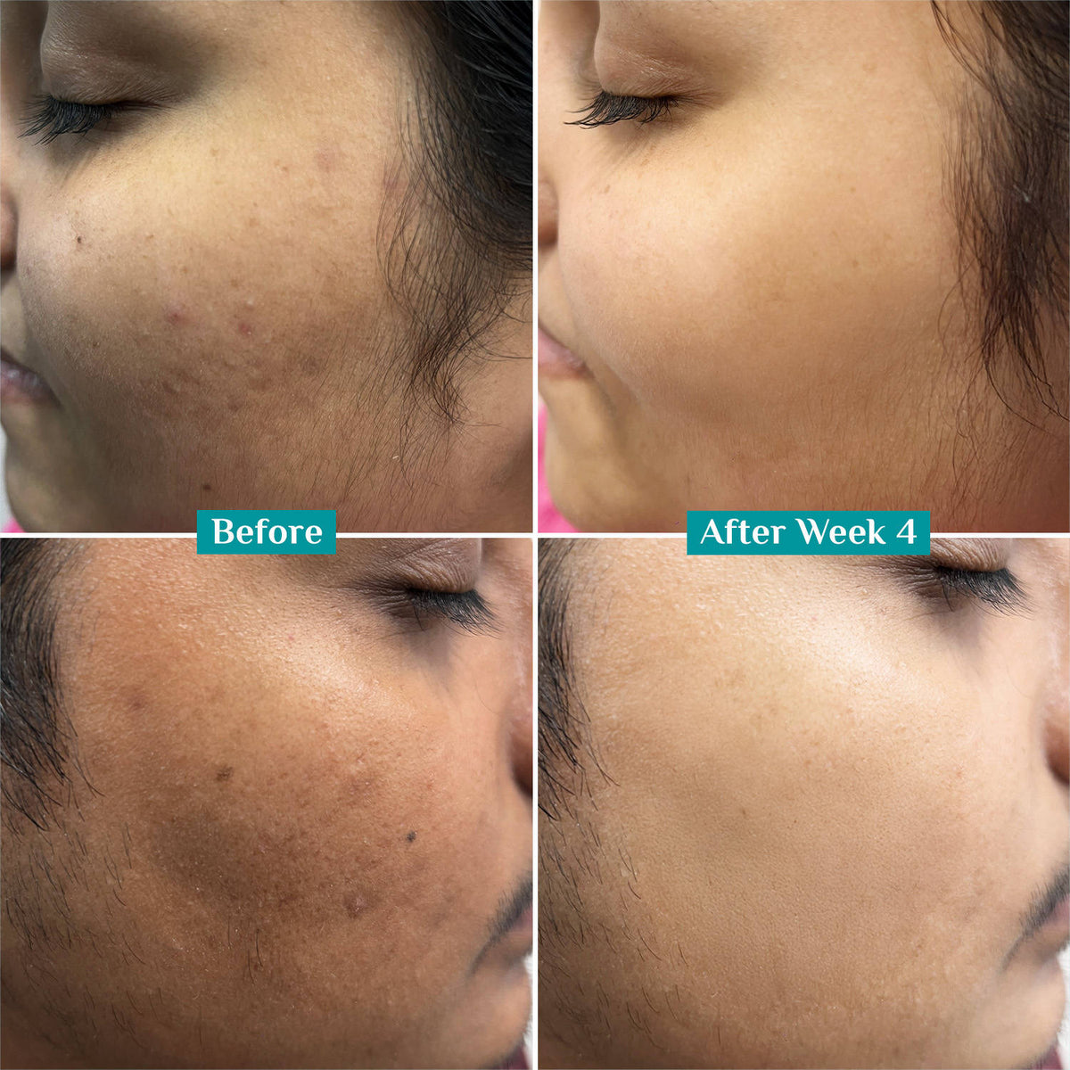 10% Niacinamide with Kojic Acid & Korean Rice Water Face Serum For Clear Glass Skin Glow | Z8 - view 5