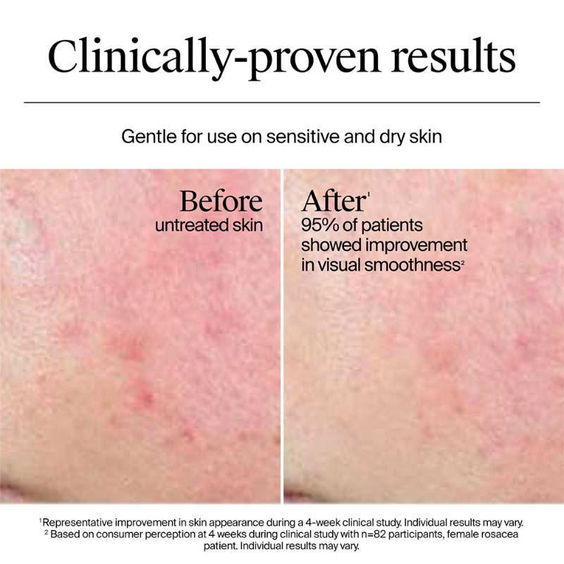 Hydro Boost Nourishing Cream Moisturizer with Hyaluronic Acid + Ceramides For Dry Skin | FC3 - view 3