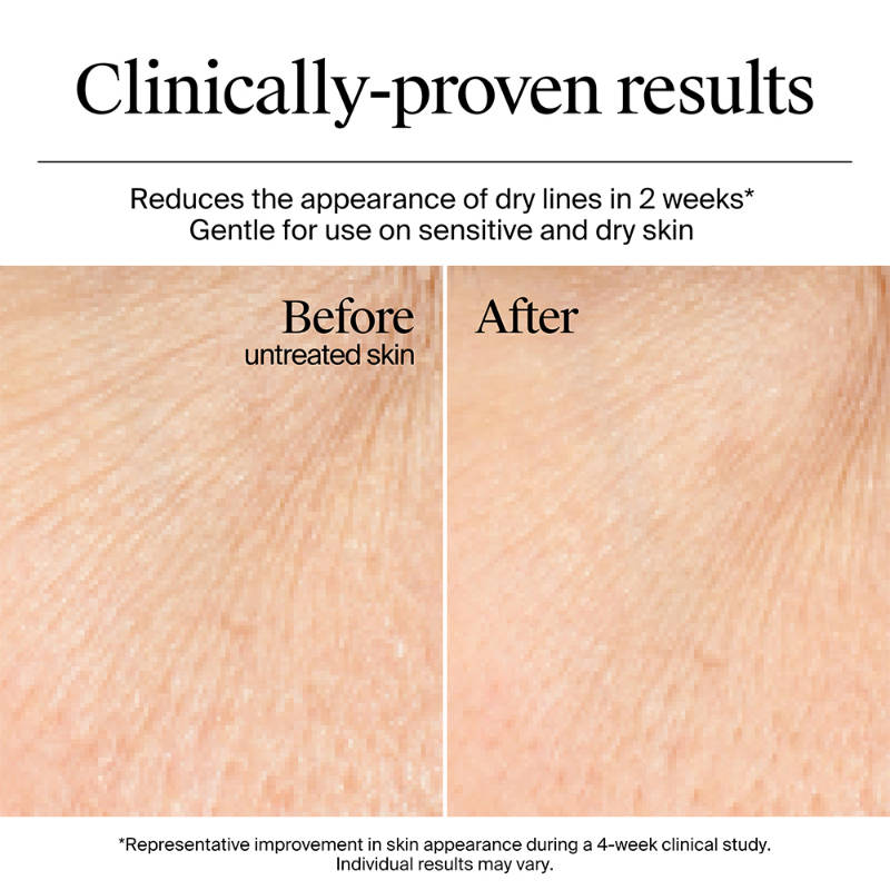 Hydro Boost Nourishing Cream Moisturizer with Hyaluronic Acid + Ceramides For Dry Skin | FC3 - view 4