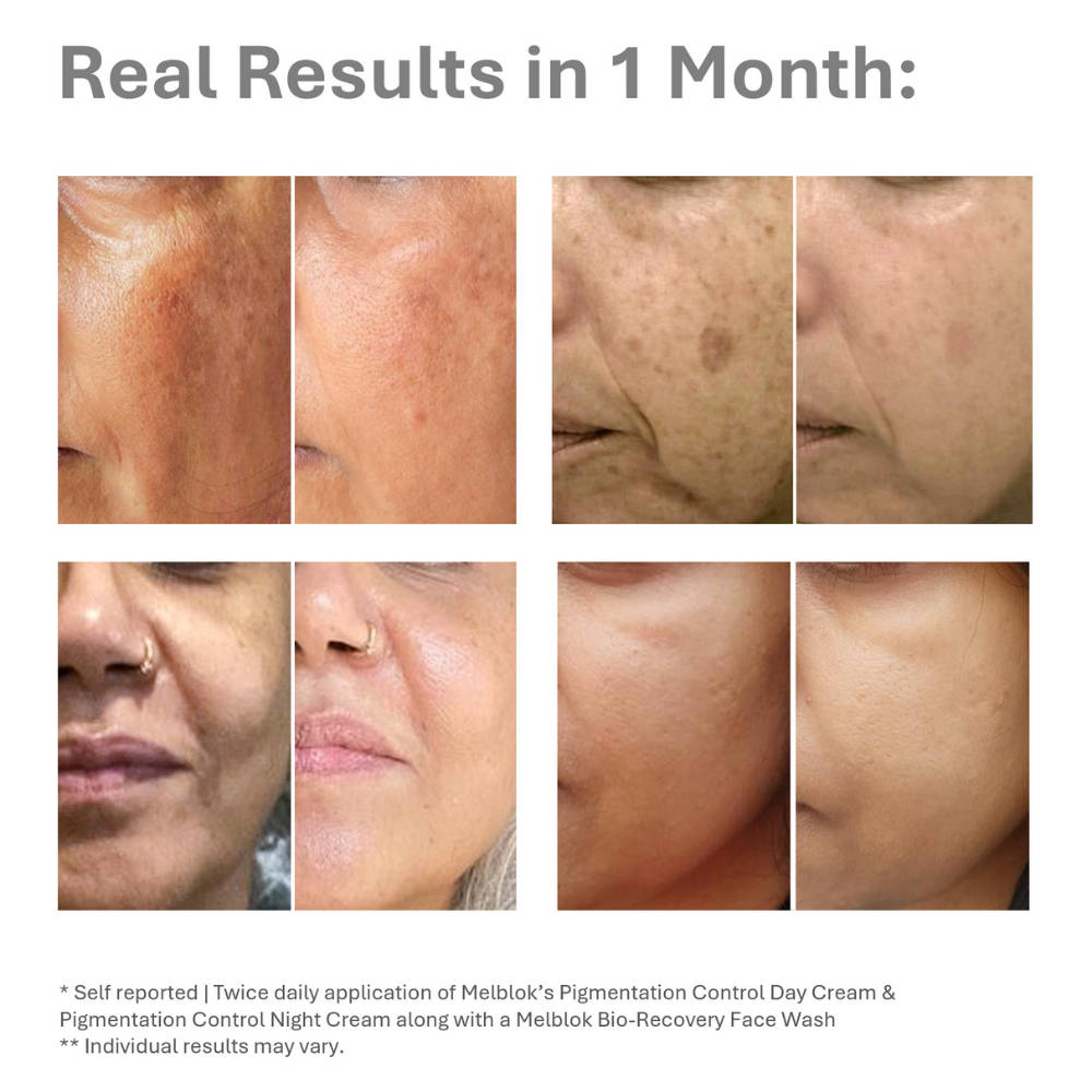 Pigmentation Control Day Cream - SPF 50+, PA++++ | FC3 - view 3