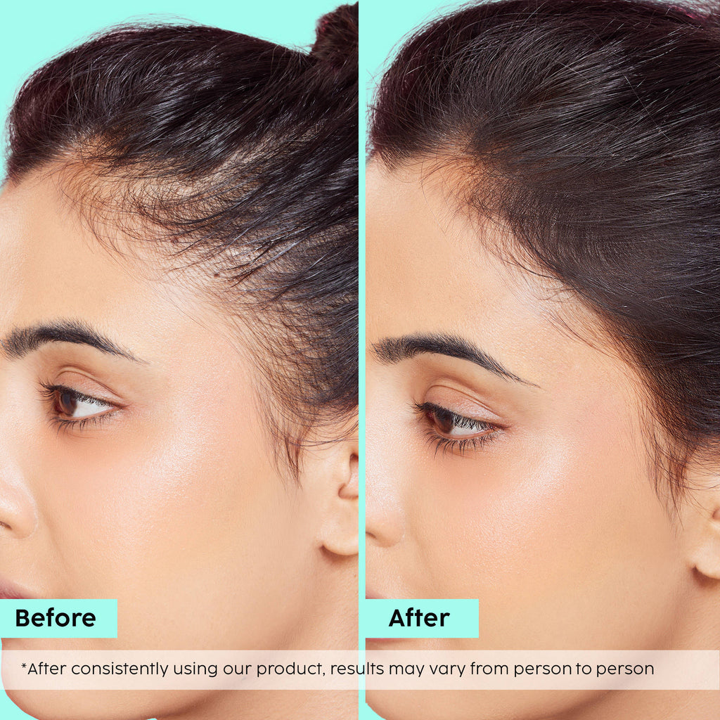 Rosemary Hair Growth Advanced Hair Spray | PL1 - view 7