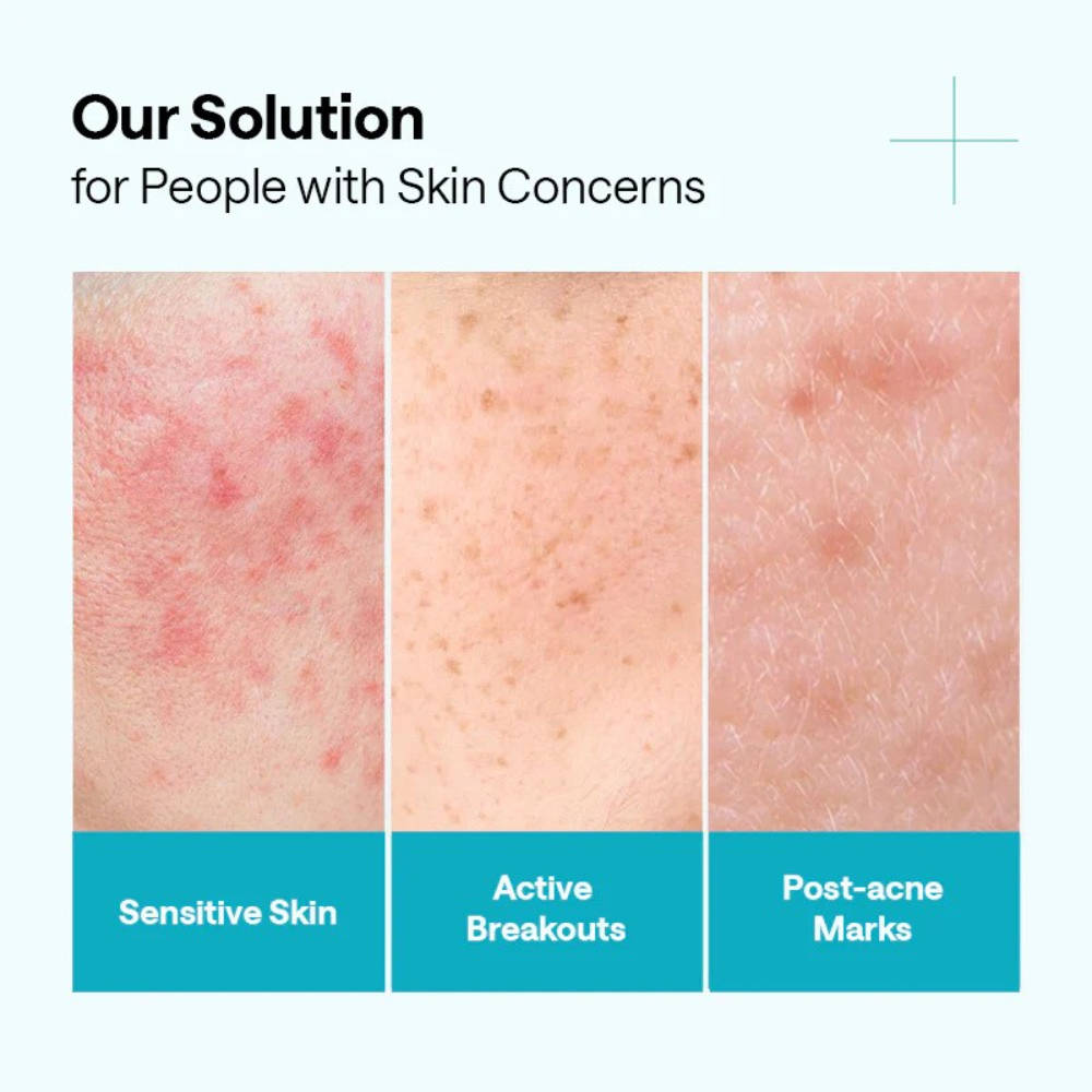 Madecassoside Blemish Repair Serum - Korean Face Serum with Centella Asiatica & Niacinamide | Z8 - view 3