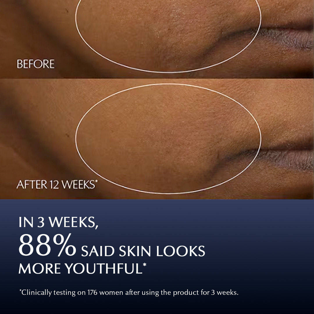 Advanced Night Repair Synchronized Multi-Recovery Complex With Hyaluronic Acid (Serum) | Z8 - view 3