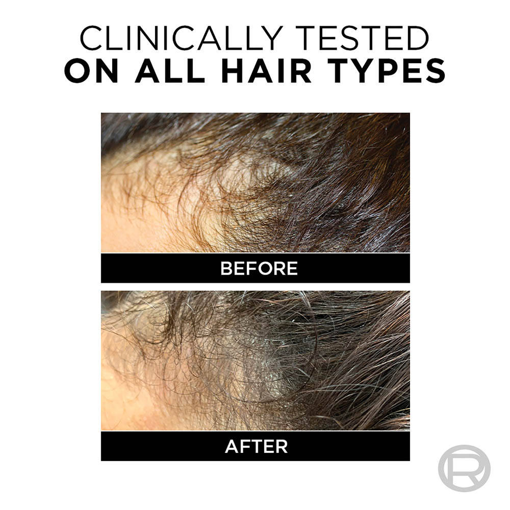 Fall Resist 3x Anti-Hair Fall Conditioner For Fragile Hair | H85 - view 4